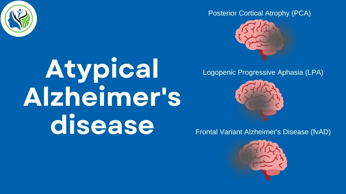 Alzheimer's progression